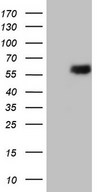 HEK293T cells were transfected with the pCMV6-ENTRY control (Left lane) or pCMV6-ENTRY ESRRB (Right lane) cDNA for 48 hrs and lysed. Equivalent amounts of cell lysates (5 ug per lane) were separated by SDS-PAGE and immunoblotted with anti-ESRRB.