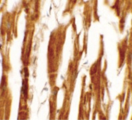 Immunohistochemistry of ESRR8 in human heart tissue with ESRR8 antibody at 5 ug/ml.