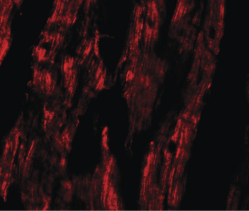 Immunofluorescence of ESRRB in human heart tissue with ESRRB antibody at 20 ug/ml.