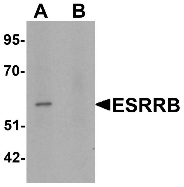 Western blot analysis of ESRRB in human heart tissue lysate with ESRRB antibody at 1 ug/ml in (A) the absence and (B) the presence of blocking peptide.