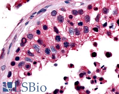 Anti-ESRRB antibody LS-A7131 IHC of human testis. Immunohistochemistry of formalin-fixed, paraffin-embedded tissue after heat-induced antigen retrieval.