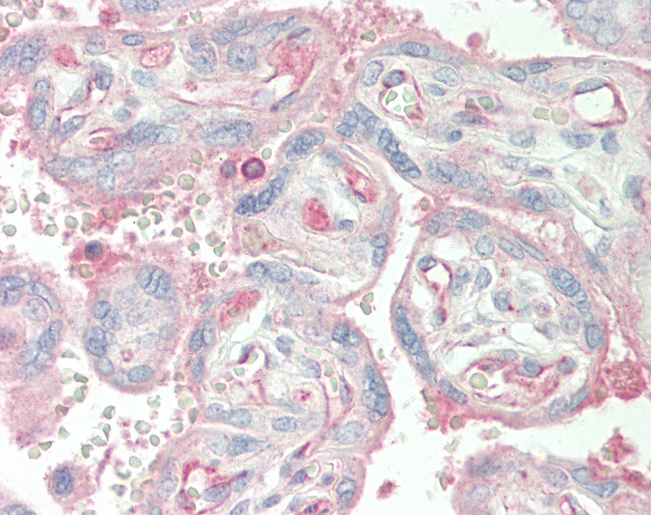 Human Placenta: Formalin-Fixed, Paraffin-Embedded (FFPE)