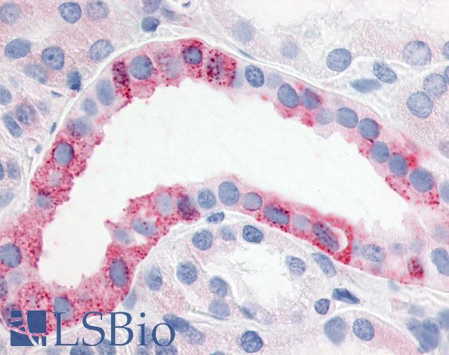 Anti-ESRRG / ERR Gamma antibody IHC of human kidney. Immunohistochemistry of formalin-fixed, paraffin-embedded tissue after heat-induced antigen retrieval.