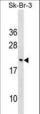 CNIH3 Antibody western blot of SK-BR-3 cell line lysates (35 ug/lane). The CNIH3 antibody detected the CNIH3 protein (arrow).