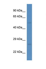 ESRRG / ERR3 antibody LS-C134943 Western blot of Rat Liver lysate. Antibody concentration 1 ug/ml.