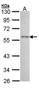 Sample (30 ug of whole cell lysate). A: A431. 10% SDS PAGE. ESRRG antibody diluted at 1:3000