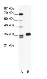 A: Marker, B: HepG2 Cell Lysate