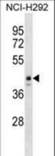ESX1 Antibody western blot of NCI-H292 cell line lysates (35 ug/lane). The ESX1 antibody detected the ESX1 protein (arrow).