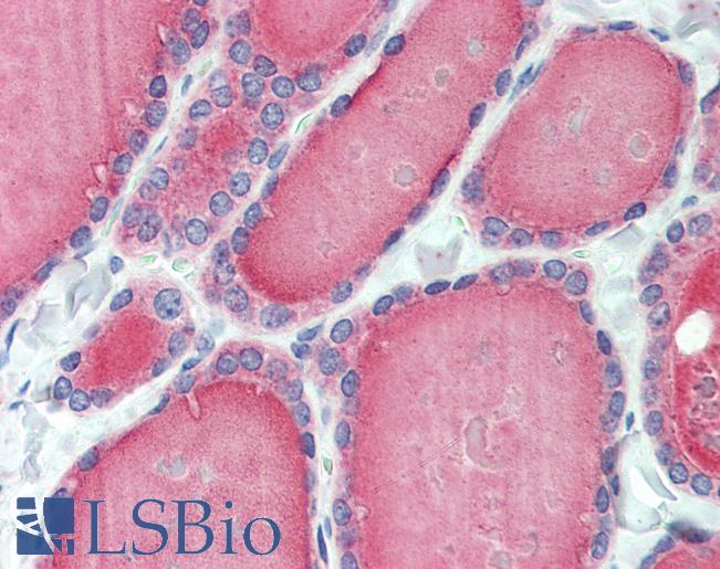 Anti-ESYT1 / FAM62A antibody LS-A9549 IHC of human thyroid. Immunohistochemistry of formalin-fixed, paraffin-embedded tissue after heat-induced antigen retrieval.