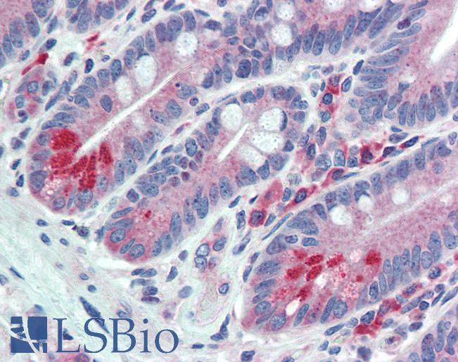 Anti-ESYT1 / FAM62A antibody LS-A9549 IHC of human small intestine. Immunohistochemistry of formalin-fixed, paraffin-embedded tissue after heat-induced antigen retrieval.