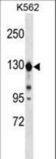 ESYT1 Antibody western blot of K562 cell line lysates (35 ug/lane). The ESYT1 antibody detected the ESYT1 protein (arrow).