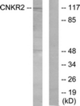 Western blot of extracts from Jurkat cells, using CNKR2 Antibody. The lane on the right is treated with the synthesized peptide.