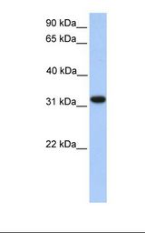 Fetal heart lysate. Antibody concentration: 1.0 ug/ml. Gel concentration: 12%.