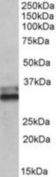 ETFA antibody (0.1 ug/ml) staining of Human Colon lysate (35 ug protein/ml in RIPA buffer). Primary incubation was 1 hour. Detected by chemiluminescence.