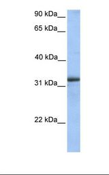 Fetal heart lysate. Antibody concentration: 1.0 ug/ml. Gel concentration: 12%.