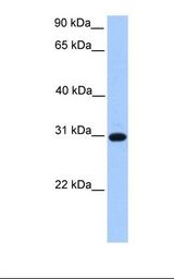 Fetal heart lysate. Antibody concentration: 1.0 ug/ml. Gel concentration: 12%.