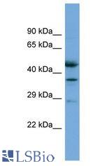 ETFB antibody Western Blot of COLO205. Antibody dilution: 1 ug/ml.