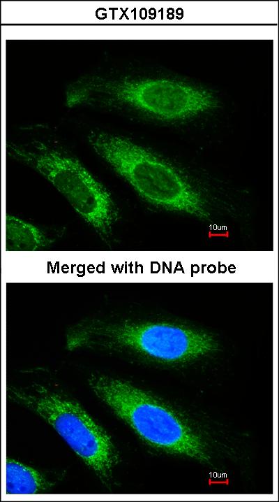 Immunofluorescence of paraformaldehyde-fixed HeLa using Beta-ETF antibody at 1:200 dilution.