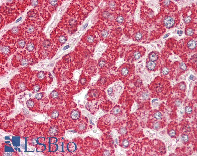 Anti-ETFB antibody IHC staining of human liver. Immunohistochemistry of formalin-fixed, paraffin-embedded tissue after heat-induced antigen retrieval.