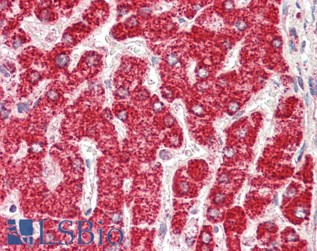 Anti-ETFB antibody IHC staining of human liver. Immunohistochemistry of formalin-fixed, paraffin-embedded tissue after heat-induced antigen retrieval.