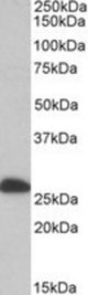 ETFB antibody (0.1 ug/ml) staining of Human Liver lysate (35 ug protein/ml in RIPA buffer). Primary incubation was 1 hour. Detected by chemiluminescence.