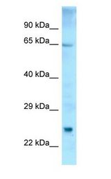 ETFDH antibody Western Blot of Fetal Thymus.