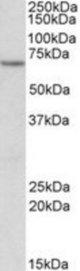 ETFDH antibody (1 ug/ml) staining of Human Kidney lysate (35 ug protein/ml in RIPA buffer). Primary incubation was 1 hour. Detected by chemiluminescence.