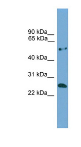 ETHE1 antibody LS-C117062 Western blot of COLO205 cell lysate.
