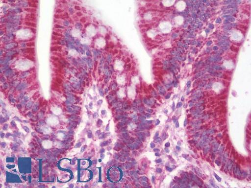 Anti-ETHE1 antibody IHC staining of human small intestine. Immunohistochemistry of formalin-fixed, paraffin-embedded tissue after heat-induced antigen retrieval. Antibody LS-B10538 dilution 1:100.