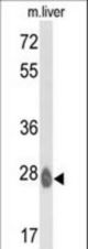 Western blot of ETHE1 Antibody in mouse liver tissue lysates (35 ug/lane). ETHE1 (arrow) was detected using the purified antibody.