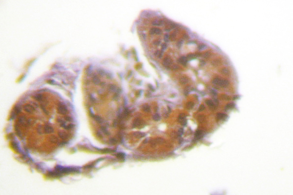 IHC of ETK (K35) pAb in paraffin-embedded human skin tissue.