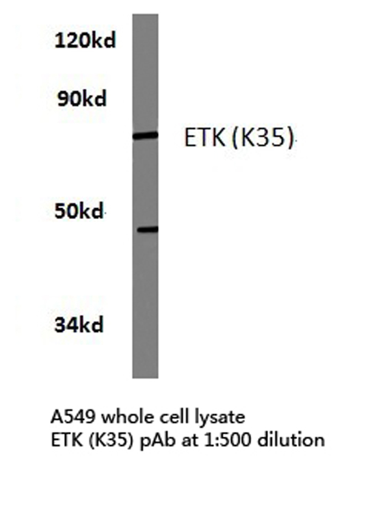 Western blot of ETK (K35) pAb in extracts from A549 cells.