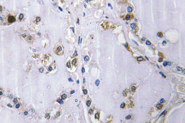 IHC of Bmx (Y43) pAb in paraffin-embedded human thyroid gland tissue.