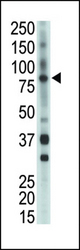 The anti-BMX antibody is used in Western blot to detect BMX in mouse heart tissue lysate.