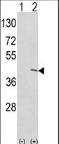 Western blot of EKI1 (arrow) using rabbit polyclonal hEKI1-C3. 293 cell lysates (2 ug/lane) either nontransfected (Lane 1) or transiently transfected with the EKI1 gene (Lane 2) (Origene Technologies).