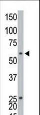 The anti-EKI1 antibody is used in Western blot to detect EKI1 in CHO cell lysate.