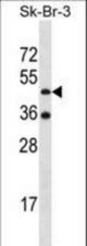 ETNK2 Antibody western blot of SK-BR-3 cell line lysates (35 ug/lane). The ETNK2 antibody detected the ETNK2 protein (arrow).
