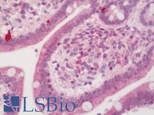 Human Small Intestine: Formalin-Fixed, Paraffin-Embedded (FFPE)