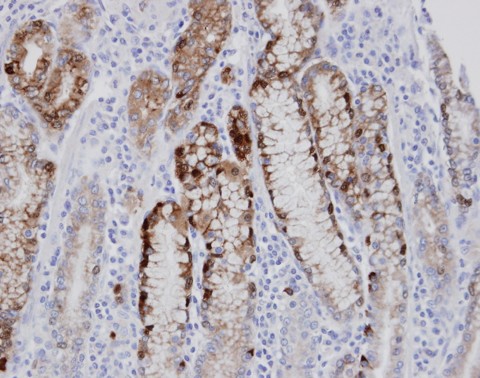 IHC of paraffin-embedded normal gastric epithelium (gland) using AGXT2L1 antibody at 1:100 dilution.