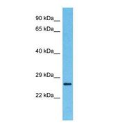 Western blot of Human Thyroid tumor. ETS1 antibody dilution 1.0 ug/ml.