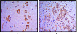 IHC of paraffin-embedded human brain tissue (A) and breast tumor (B) using ETS1 mouse monoclonal antibody.