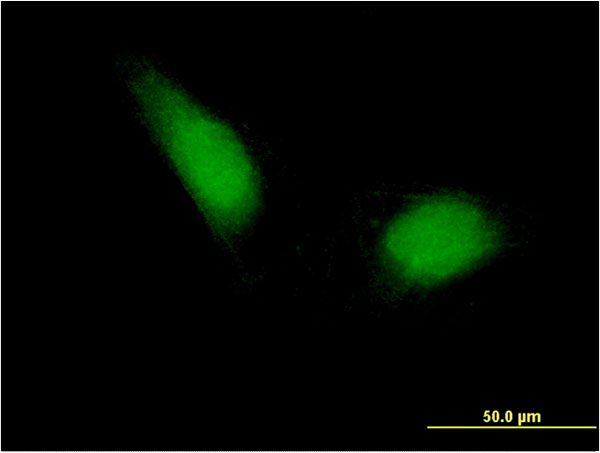 Immunofluorescence of monoclonal antibody to ETS1 on HeLa cell . [antibody concentration 10 ug/ml]