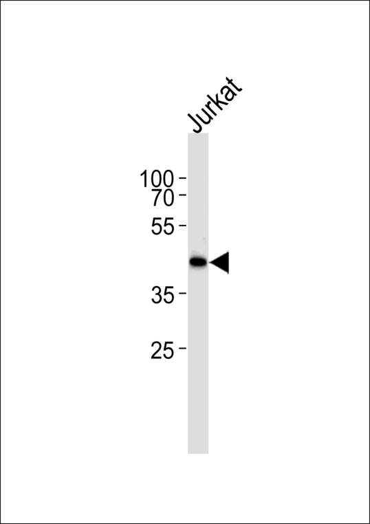 Western blot of lysate from Jurkat cell line, using ETS1 Antibody. Antibody was diluted at 1:1000 at each lane. A goat anti-rabbit IgG H&L (HRP) at 1:5000 dilution was used as the secondary antibody. Lysate at 35ug.