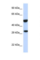 ETS2 antibody LS-C145797 Western blot of 293T Cell lysate. Antibody concentration 1 ug/ml.