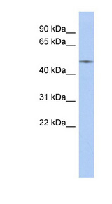 ETS2 antibody LS-C110292 Western blot of Fetal Kidney lysate.