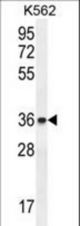 ETV2 Antibody western blot of K562 cell line lysates (35 ug/lane). The ETV2 antibody detected the ETV2 protein (arrow).