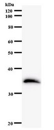 Western blot of immunized recombinant protein using ETV3 antibody.