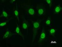 Immunostaining analysis in HeLa cells. HeLa cells were fixed with 4% paraformaldehyde and permeabilized with 0.1% Triton X-100 in PBS. The cells were immunostained with anti-ETV3 mAb.