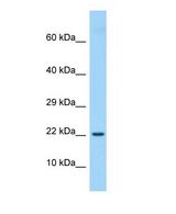 Western blot of Etv3l Antibody - middle region in Rat Thymus cells lysate.