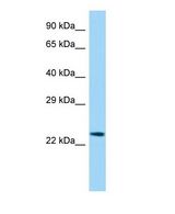 Western blot of Etv3l Antibody - middle region in Rat Spleen cells lysate.